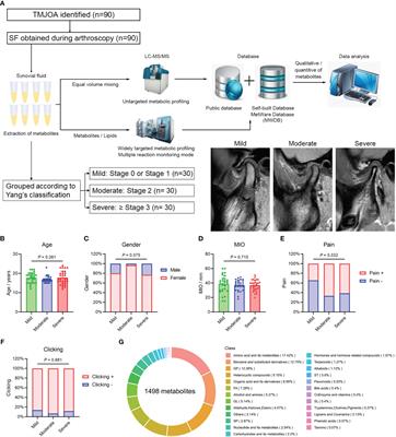 Metabolic profiling of synovial fluid in human temporomandibular joint osteoarthritis